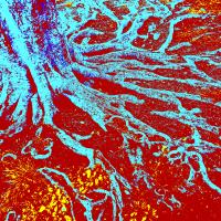 Root of the Matter